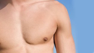 Male Breast Reduction (Gynecomastia)