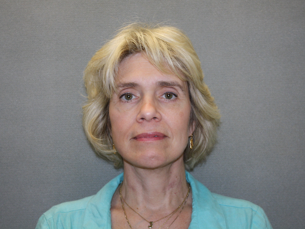 Facelift Before & After Patient #549