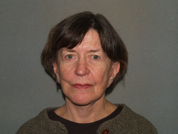 Facelift Before & After Patient #592