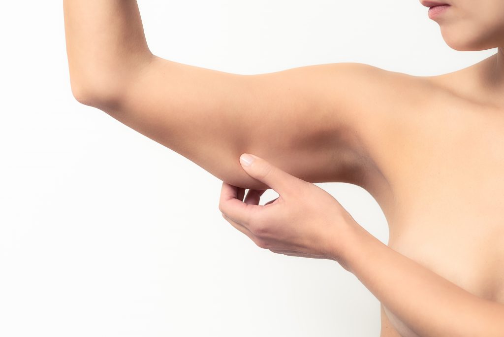 Achieve Toned and Youthful Arms with Arm Lift Surgery (Brachioplasty)