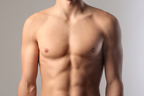 Male Breast Reduction (Gynecomastia)